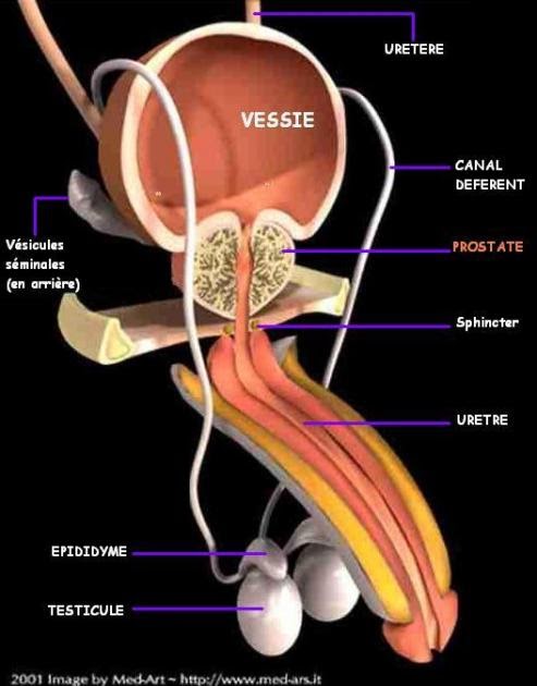 prostate gonflée traitement